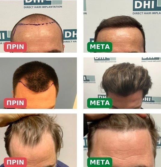 2-6DM5V.jpg