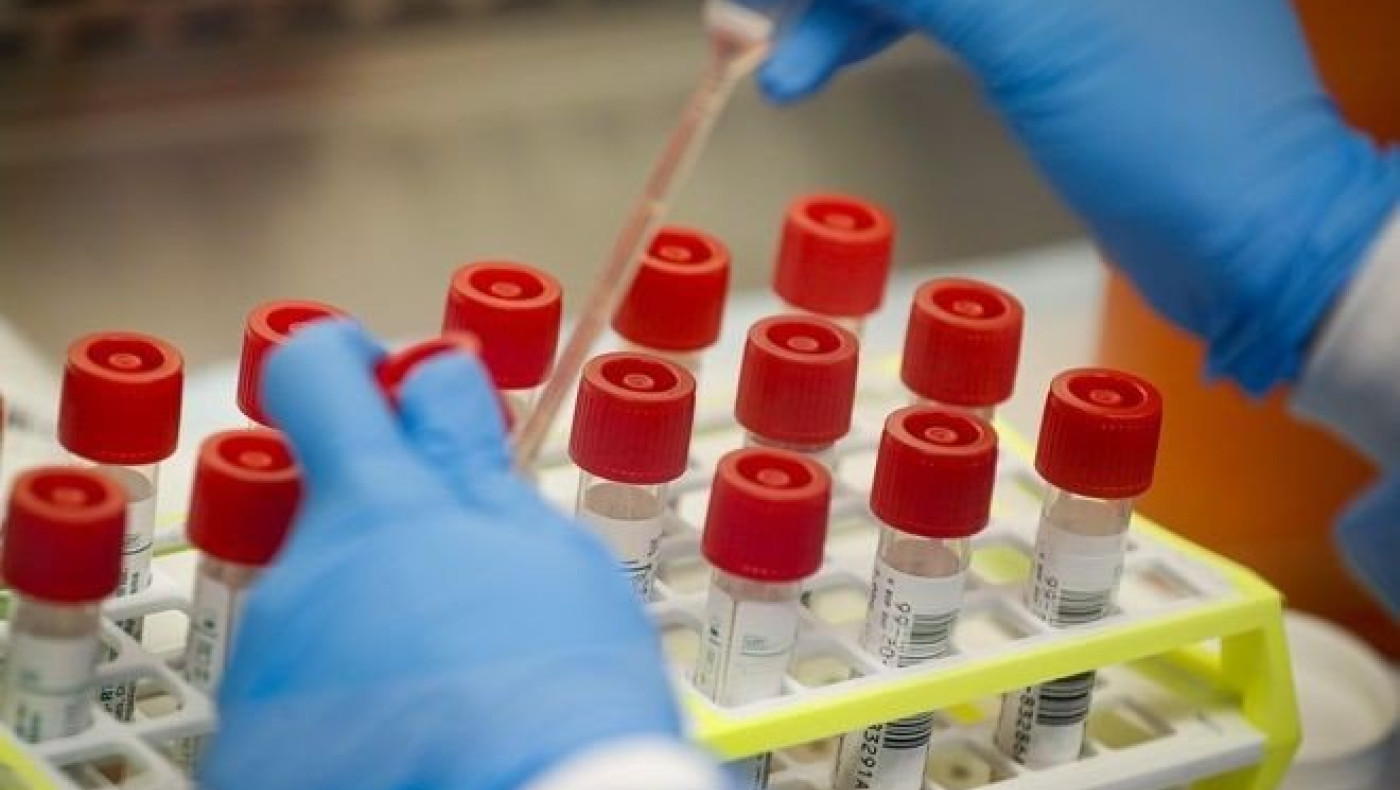 «Δεν είναι εύκολη η εύρεση εμβολίου και φαρμάκου, πηγαίνουμε στα... ημίτυφλα»