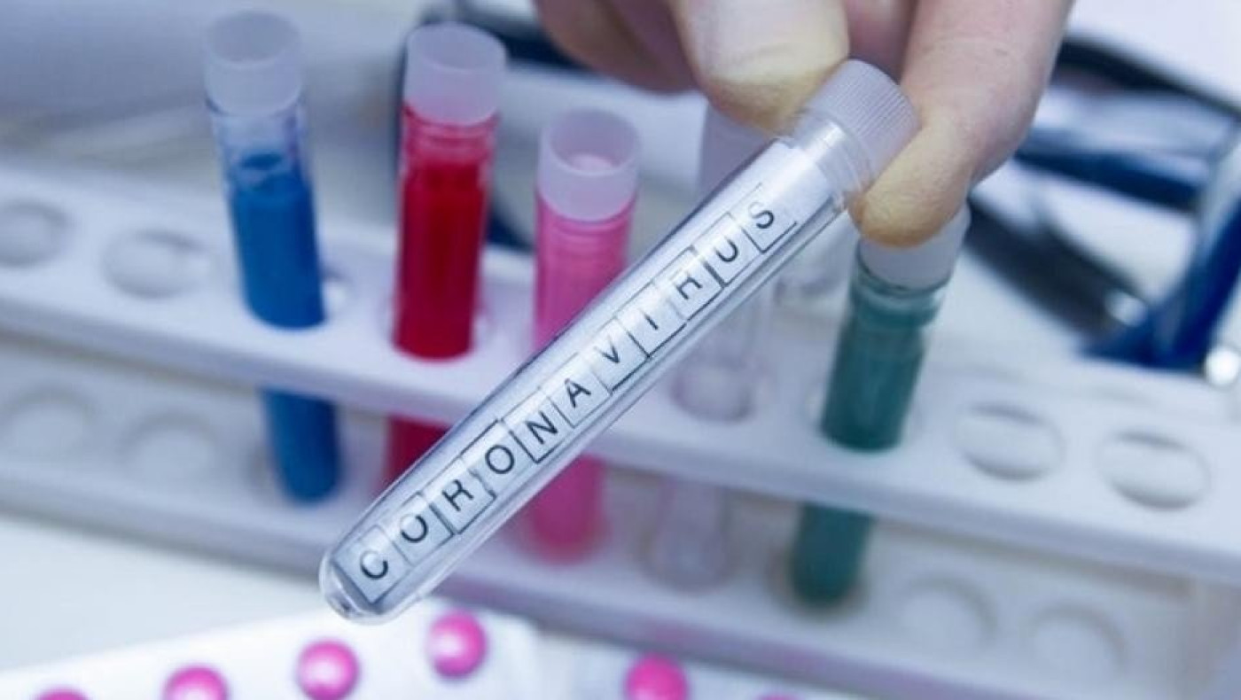 «Δεν μπορεί ο καθένας να κάνει τεστ κορωνοϊού σε διαγνωστικό κέντρο»