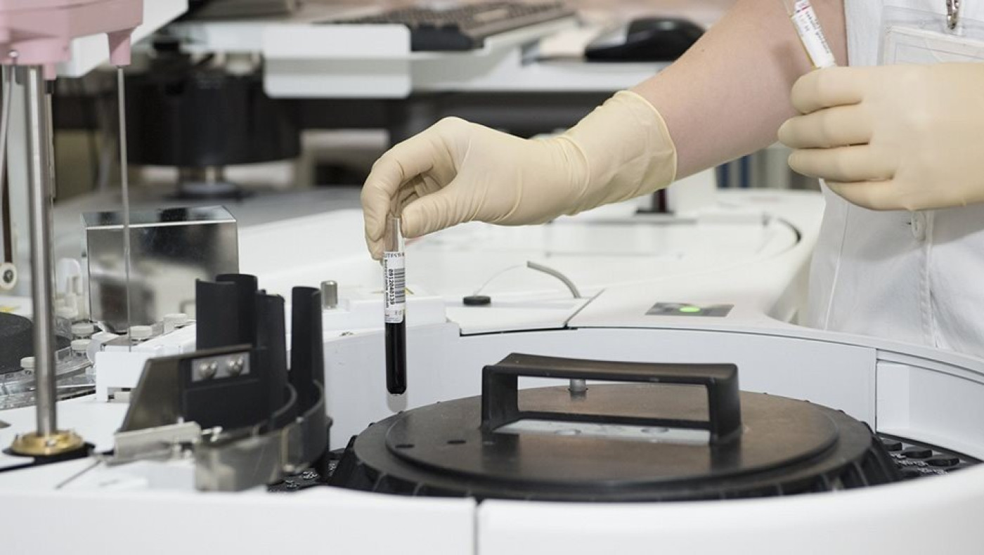 Κορωνοϊός: Ποια ζώα ήταν υπεύθυνα για τις πανδημίες