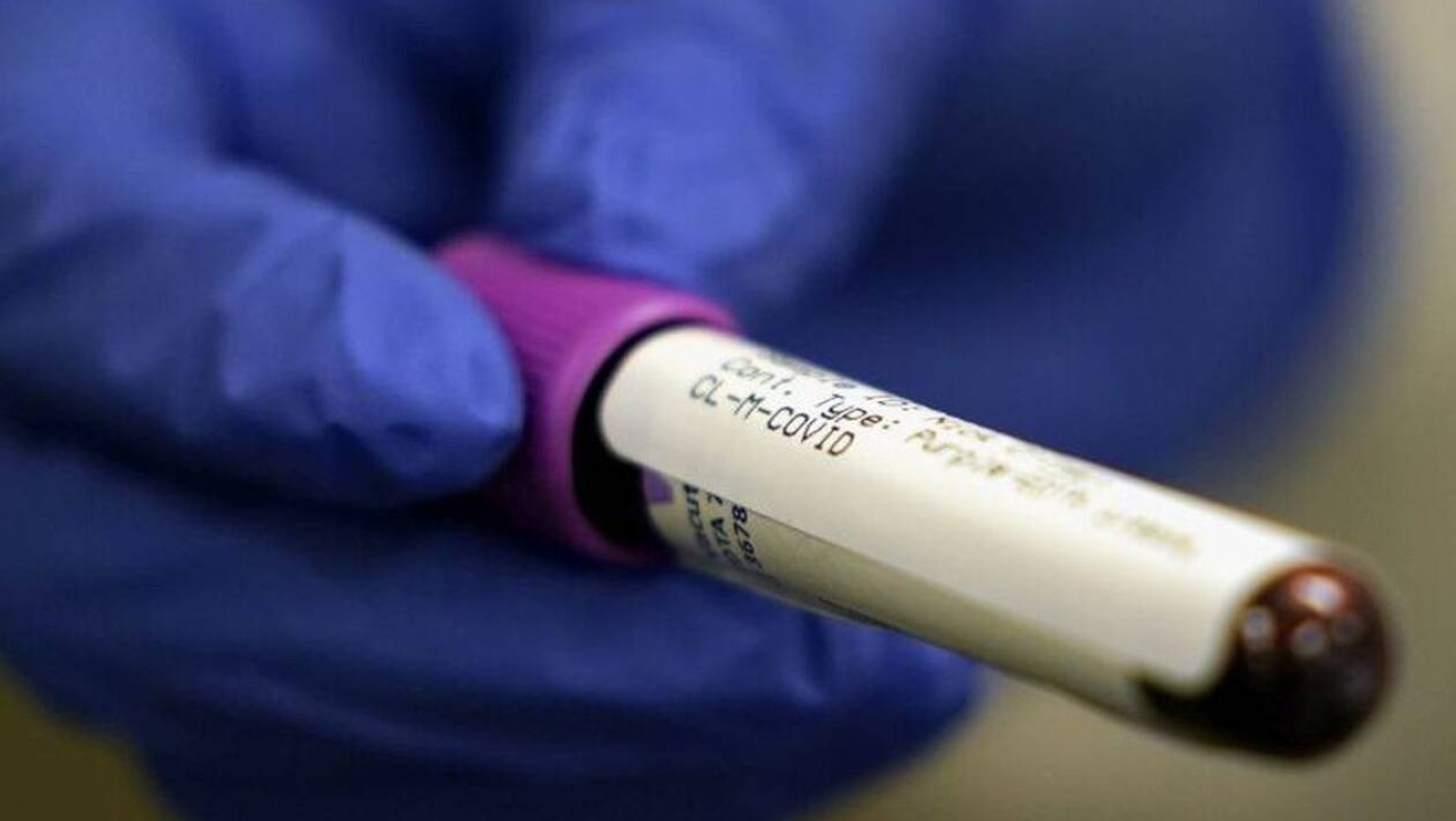 Πουλάνε «χρυσό» αίμα θεραπευμένων από τον ιό