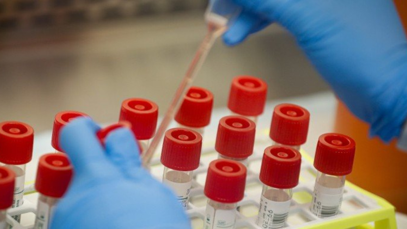 Υδροξυχλωροκίνη: Τι έδειξαν τα αποτελέσματα σε ασθενείς με κορωνοϊό