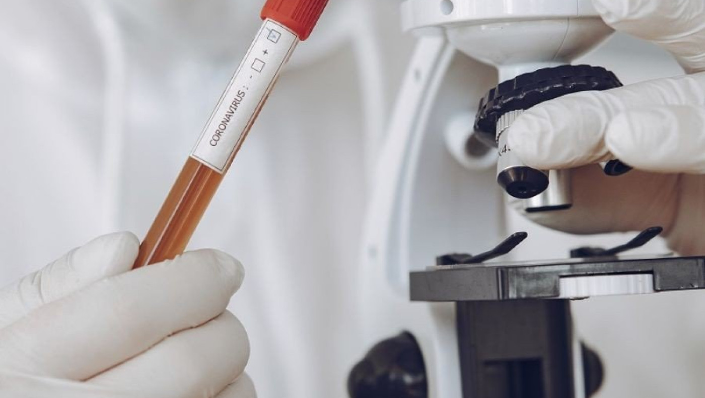 Θεσσαλονίκη: Απείλησαν ιδιοκτήτη διαγνωστικού κέντρου για τo κόστος του τεστ κορωνοϊού