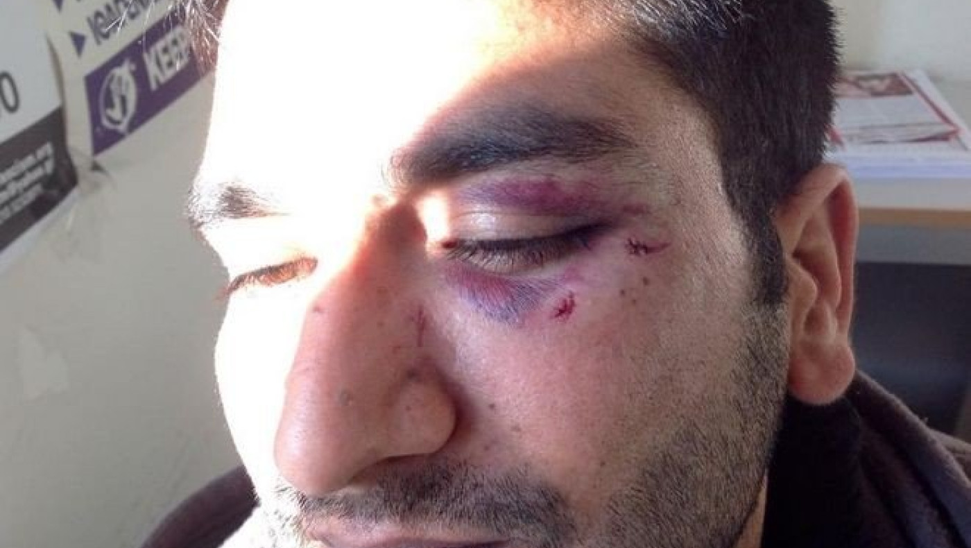 Καταγγελία: Χρυσαυγίτες χτύπησαν μετανάστες με σιδηρογροθιές