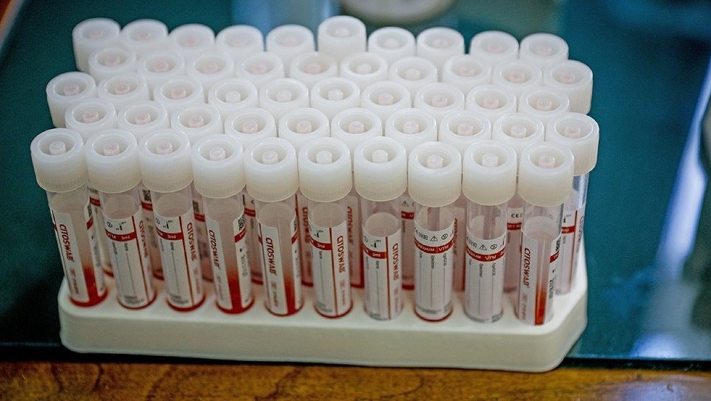 Κορωνοϊός: «Έκρηξη» στη Λάρισα, 44 νέα κρούσματα!