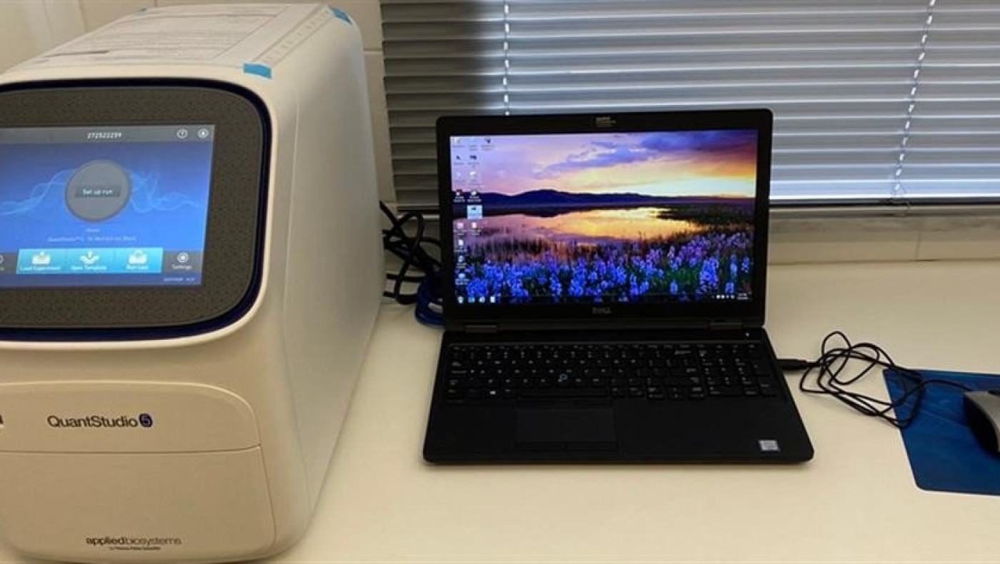 Αναλυτής κορωνοϊού, δωρεά των ΕΛΠΕ στο ΑΧΕΠΑ,﻿ θα ελέγχει έως και 5000 δείγματα ημερησίως