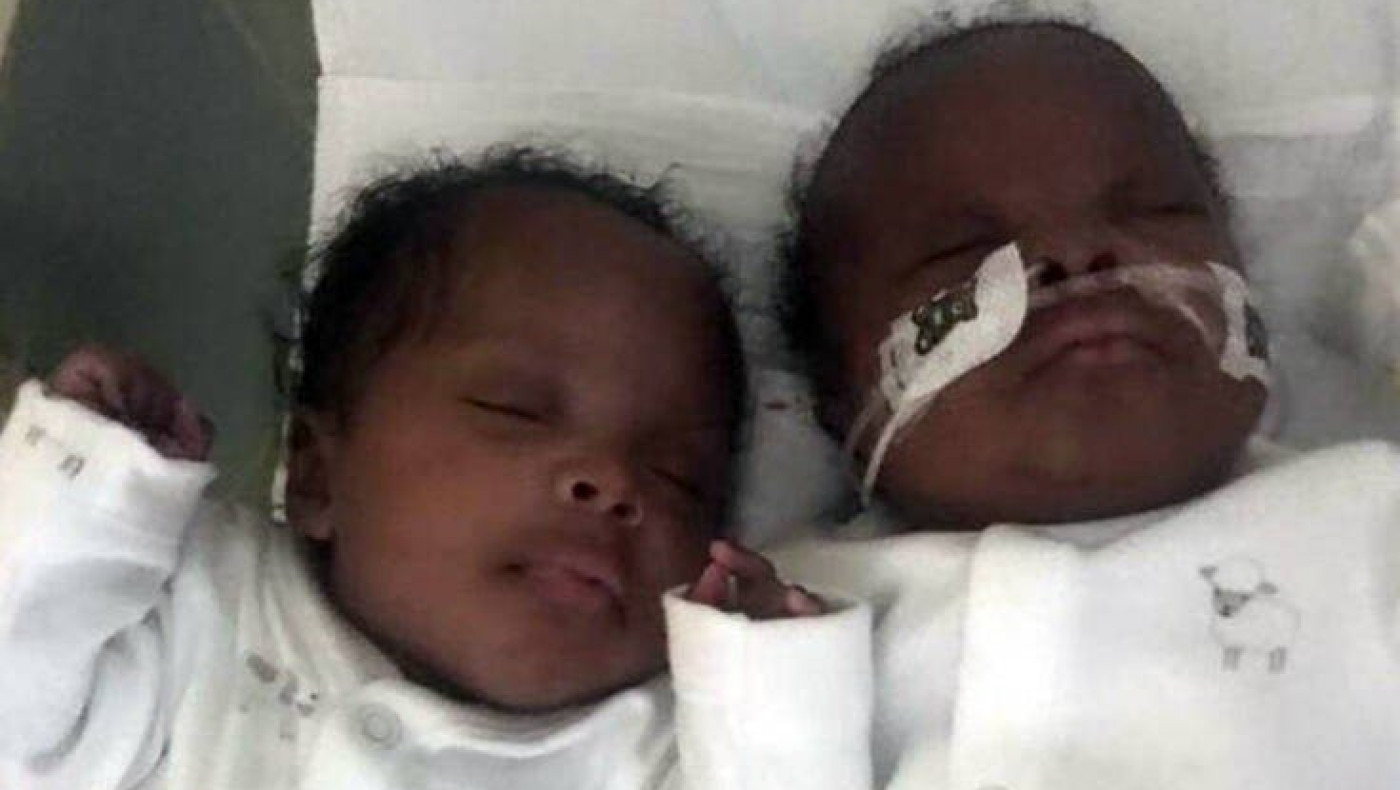 Γυναίκα γέννησε δίδυμα ενώ ήταν σε κώμα εξαιτίας του κορονοϊού