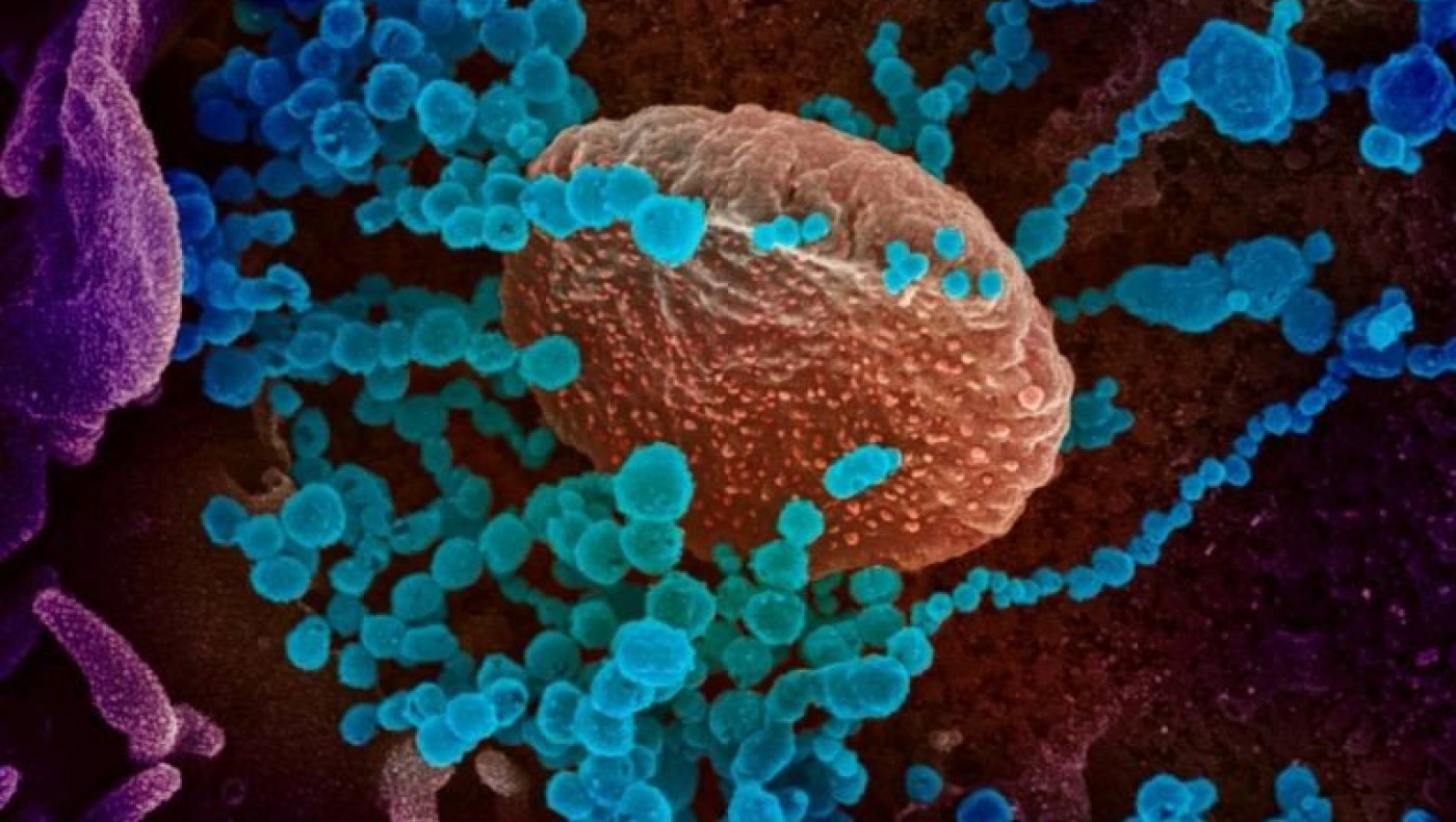 Κορωνοϊός: 1834 νέα κρούσματα στην Ελλάδα σήμερα