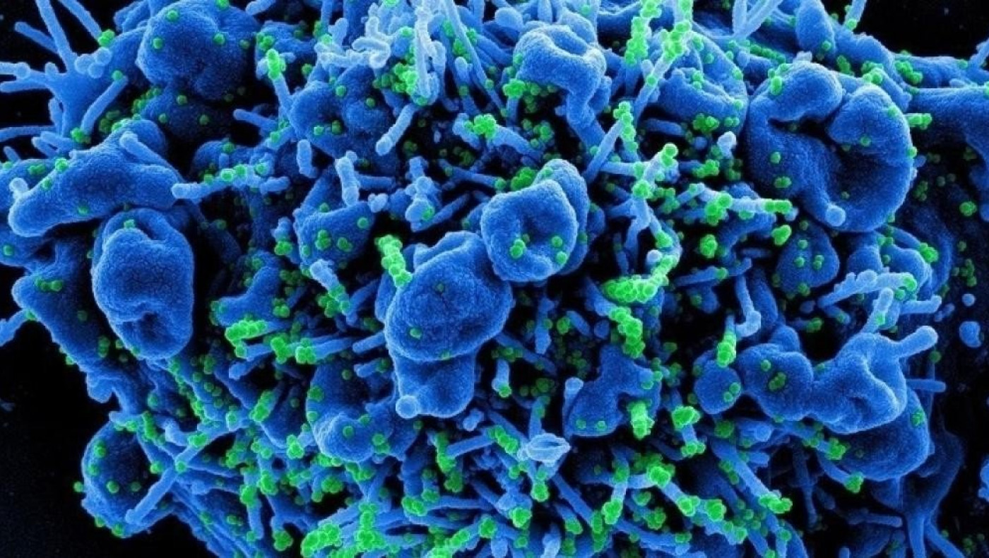 Κορωνοϊός: Προβληματισμός για την μετάλλαξη Β318 - Που εντοπίζεται