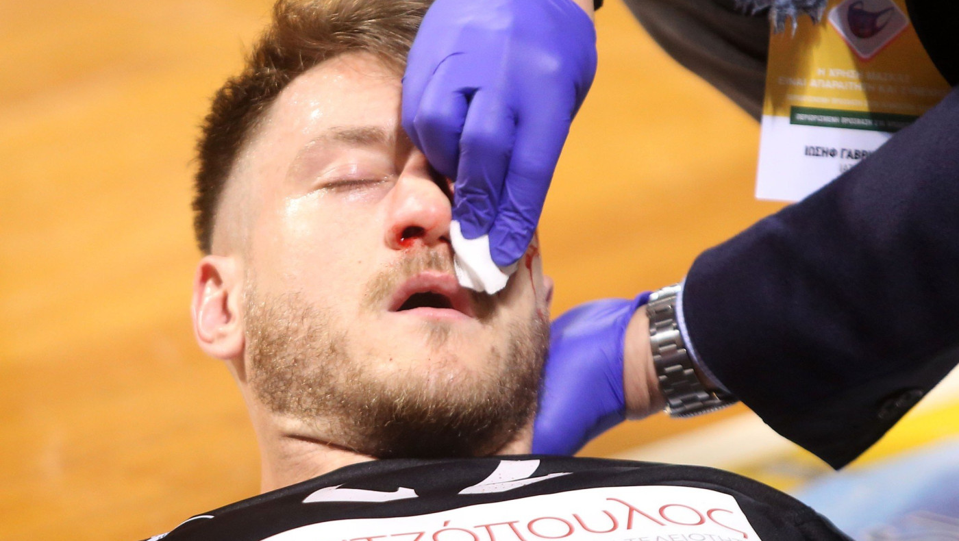 Ο Παπαντωνίου έσπασε τη μύτη του στην προθέρμανση πριν το Άρης-ΠΑΟΚ