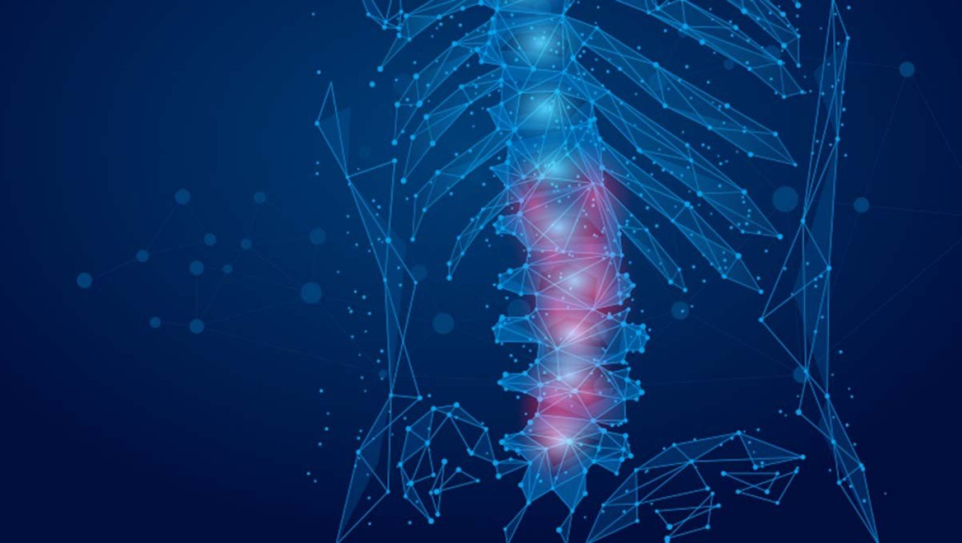 Το σύνδρομο που απειλεί τη σπονδυλική στήλη και πώς αντιμετωπίζεται