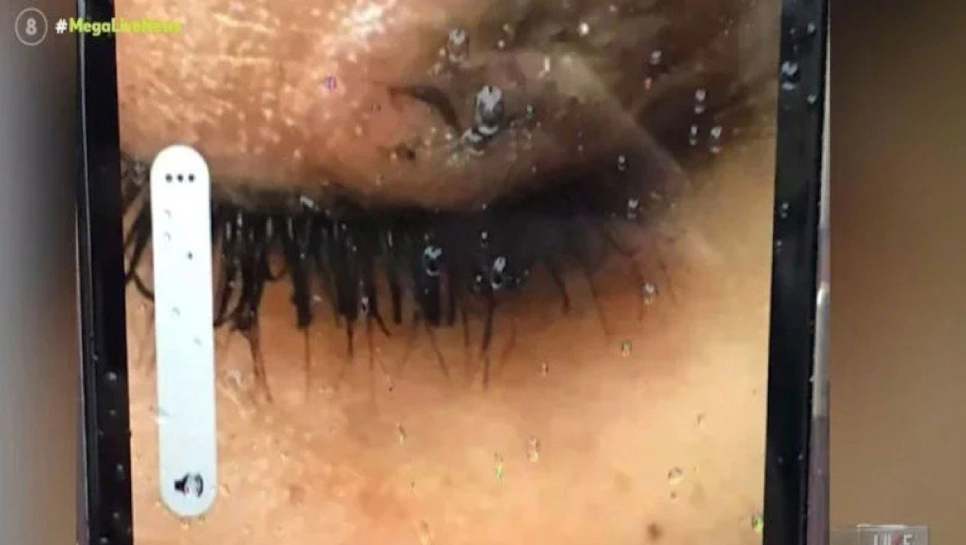 Συνελήφθη η 16χρονη που έσβησε τσιγάρο στο μάτι συμμαθήτριας!