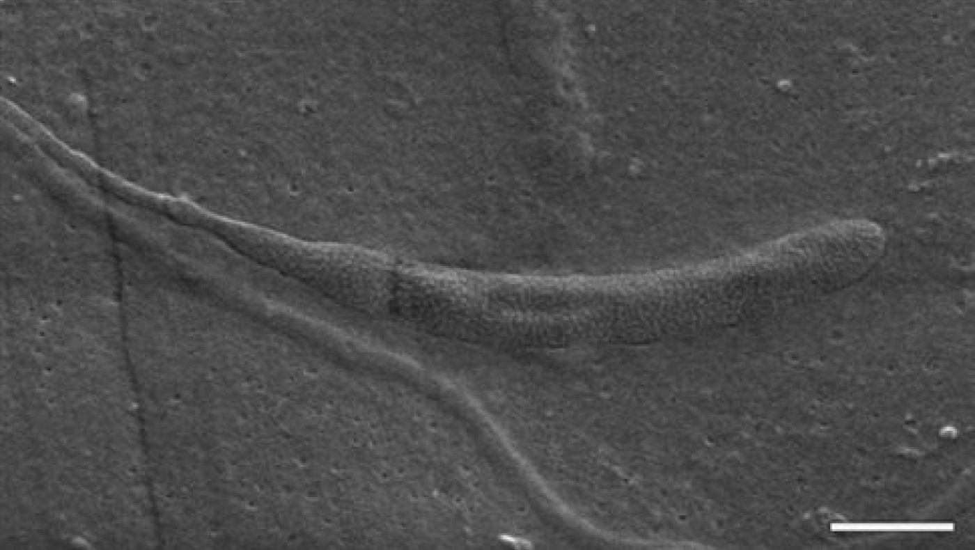 Η εκσπερμάτιση των 50 εκατομμυρίων ετών