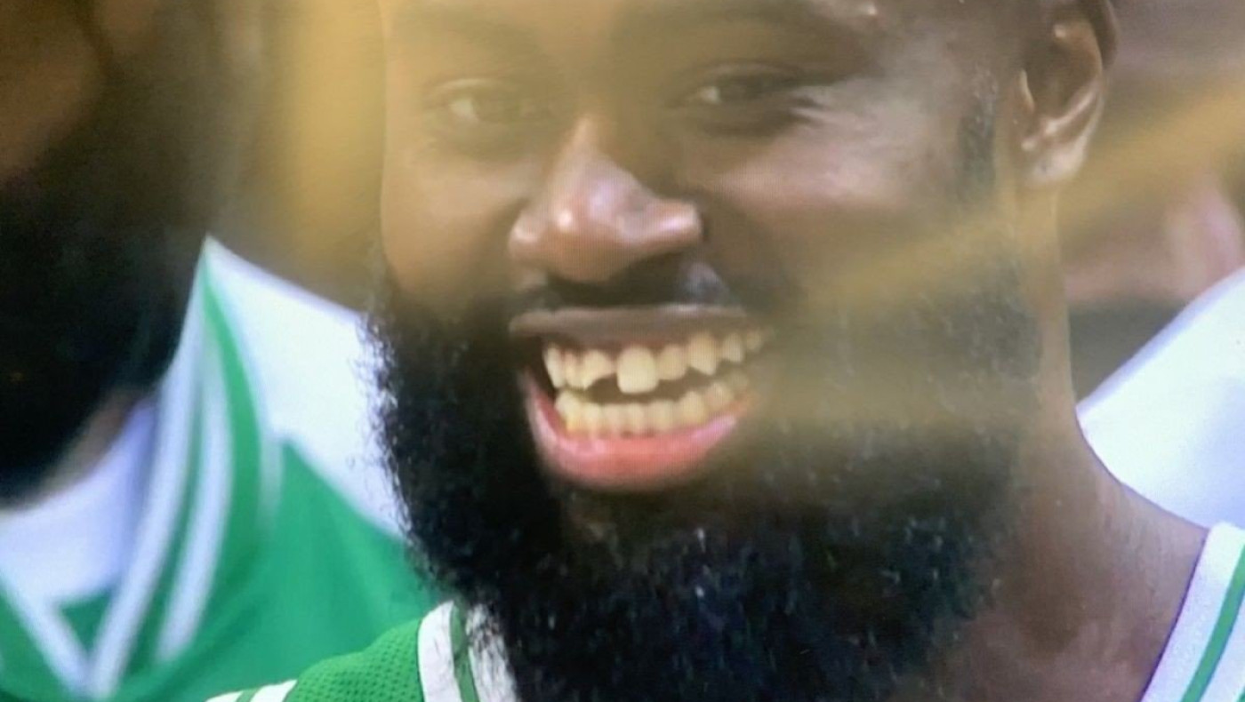 Μπακς - Σέλτικς: Έσπασε το δόντι του ο Τζέιλεν Μπράουν