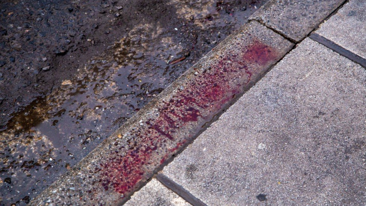 Καπραβέλος: «Ο Άλκης ήρθε νεκρός, από θαύμα ζουν οι φίλοι του»