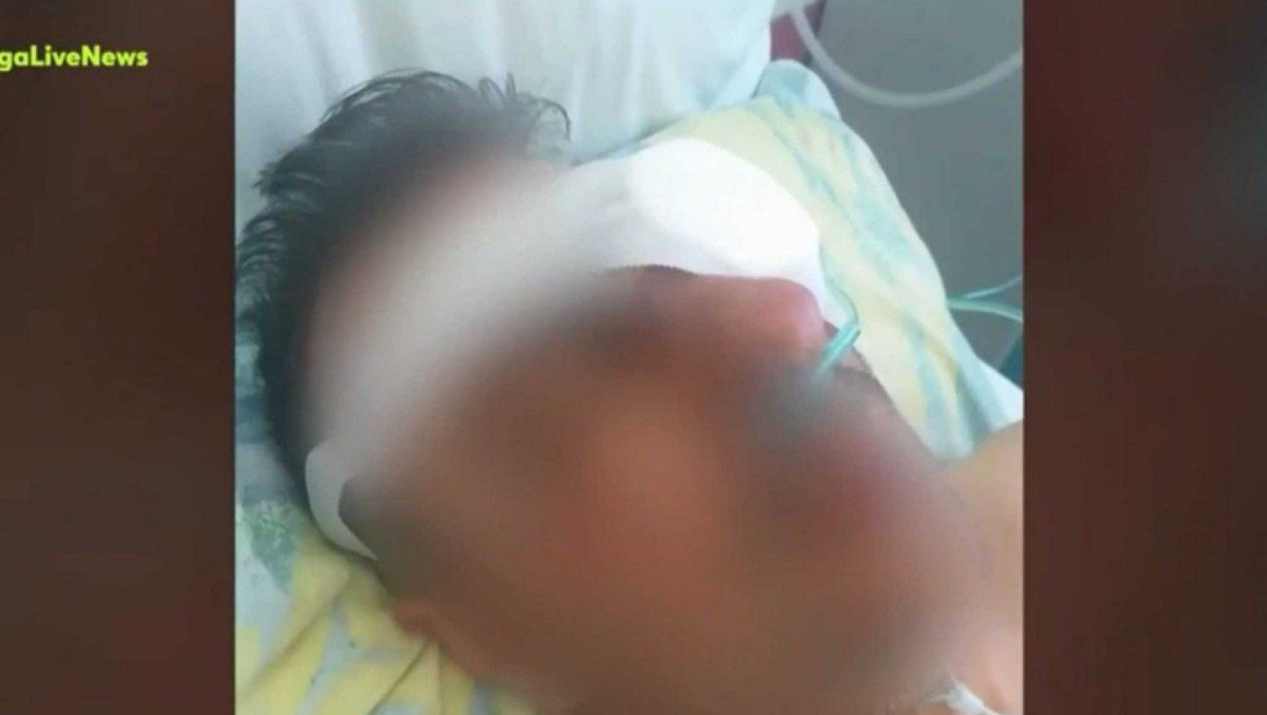 Χανιά: Του ξερίζωσε το μάτι με το δάχτυλο του για ένα κέρασμα