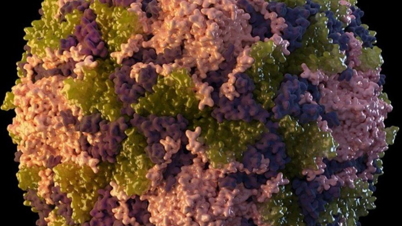 Κρούσμα της εξαφανισμένης πολιομυελίτιδας στη Νέα Υόρκη!