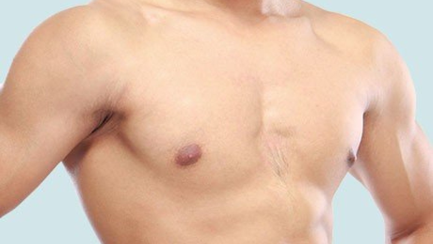 Ο ανδρικός καρκίνος του μαστού υπάρχει!