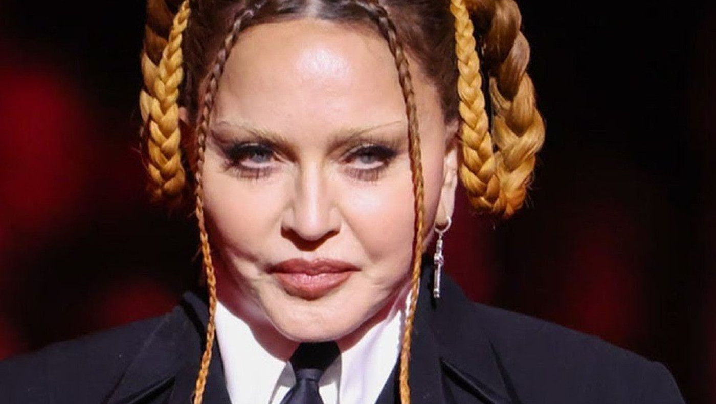 Η Μαντόνα απαντά στα σχόλια για τo φουσκωμένο πρόσωπό της στα Grammy: «Υποκλιθείτε σκύλες»