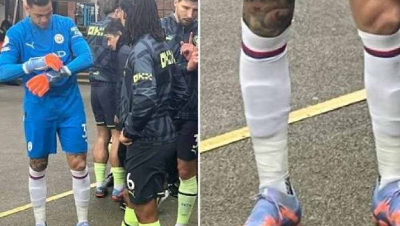 Γκάφα ή αναγκαίο...κακό; Ο Έντερσον αγωνίστηκε με τις κάλτσες τις αντίπαλης ομάδας