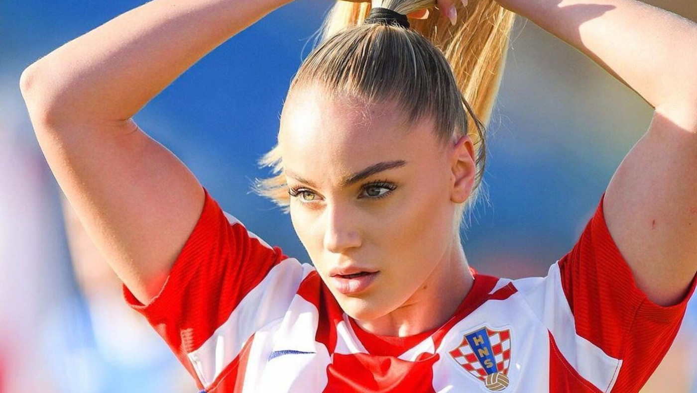 Η ομορφότερη παίκτρια στον κόσμο τραυματίστηκε και... ποζάρει