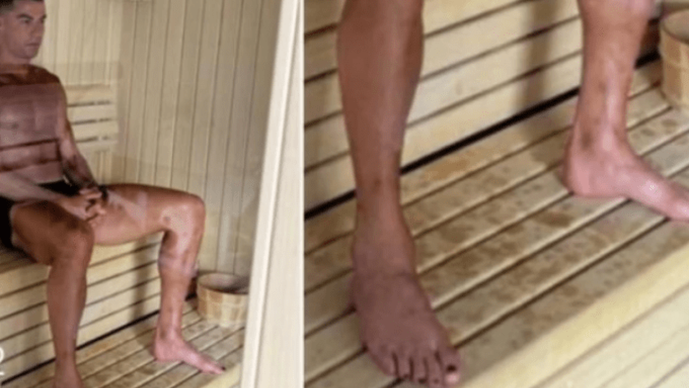 Γιατί ο Κριστιάνο βάφει μαύρα τα νύχια των ποδιών του!