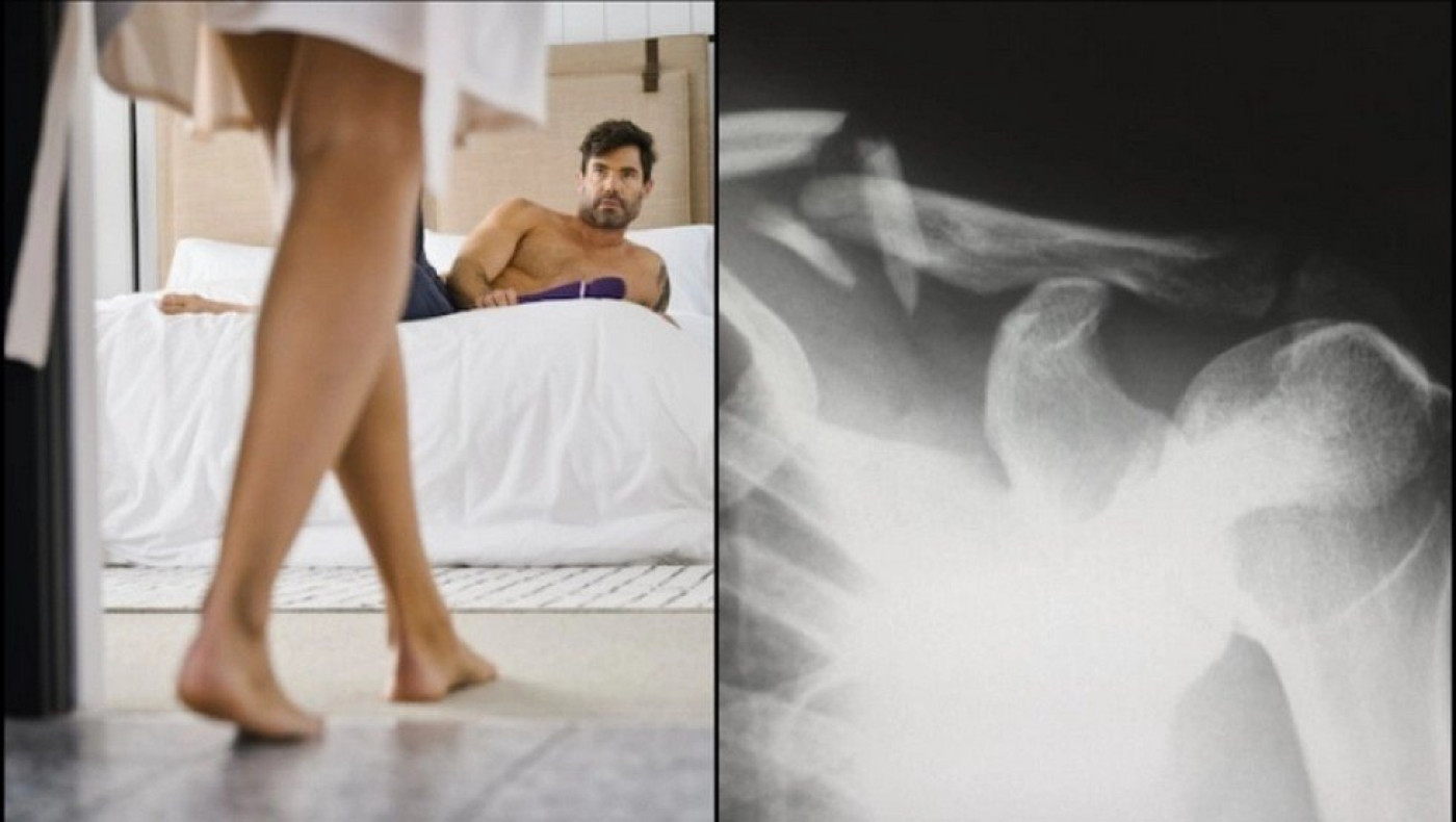 Έσπασε σε τρία σημεία το μόριό του κατά την διάρκεια της ερωτικής πράξης