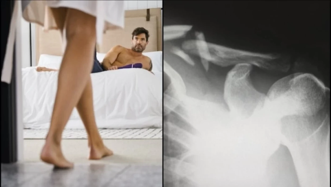 Απίστευτο ιατρικό περιστατικό: Έσπασε σε τρία σημεία το μόριό του κατά την διάρκεια ερωτικής πράξης