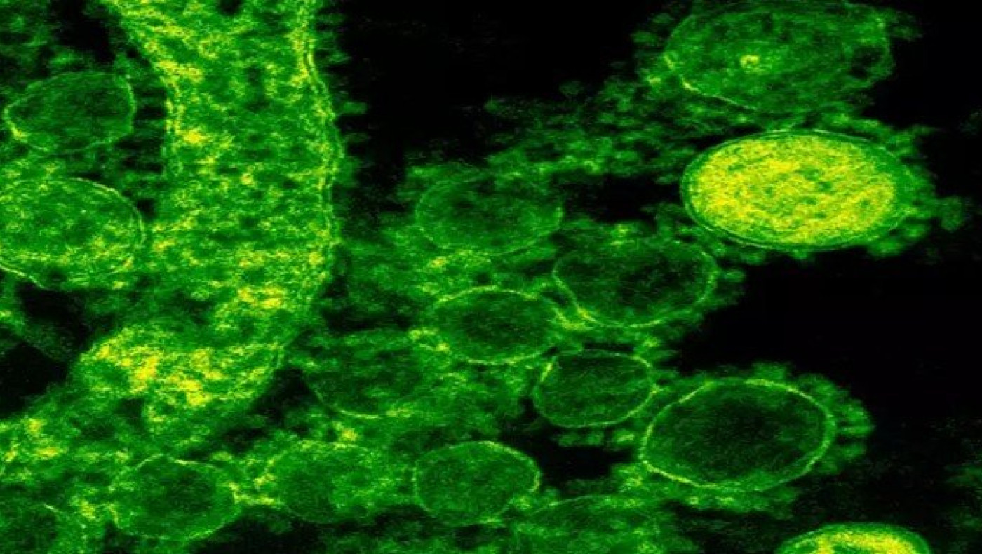 Ανακαλύφτηκε νέο αντιβιοτικό που εξουδετερώνει υπερβακτήριο!