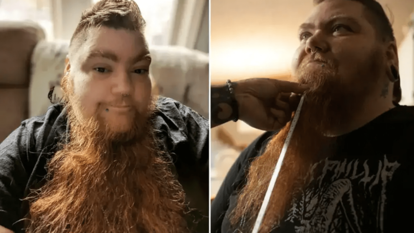 Μια 38χρονη Αμερικανίδα έσπασε το ρεκόρ Γκίνες για το πιο μακρύ γυναικείο μούσι