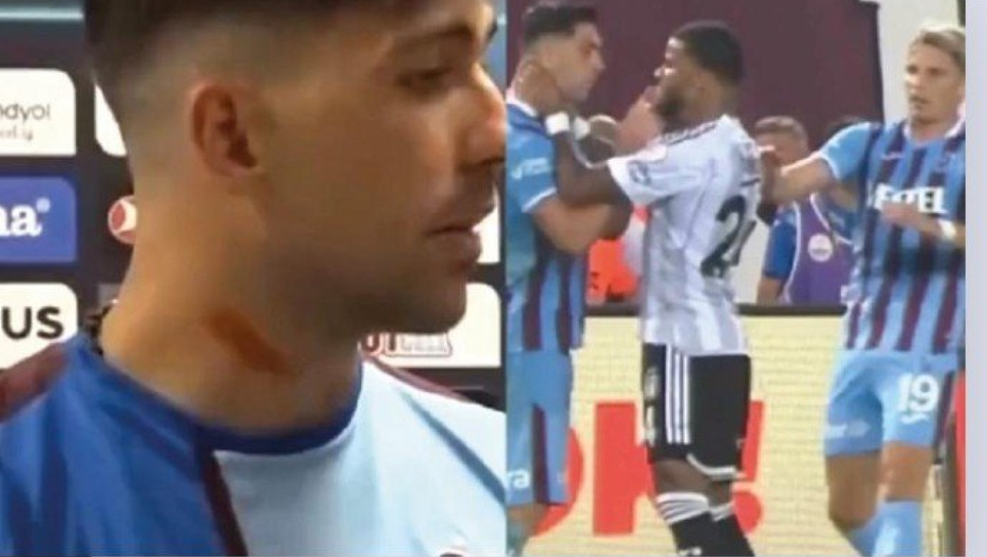 Εκτός εαυτού ο Μπακασέτας για το χτύπημα στον λαιμό του: «Είναι ντροπή»