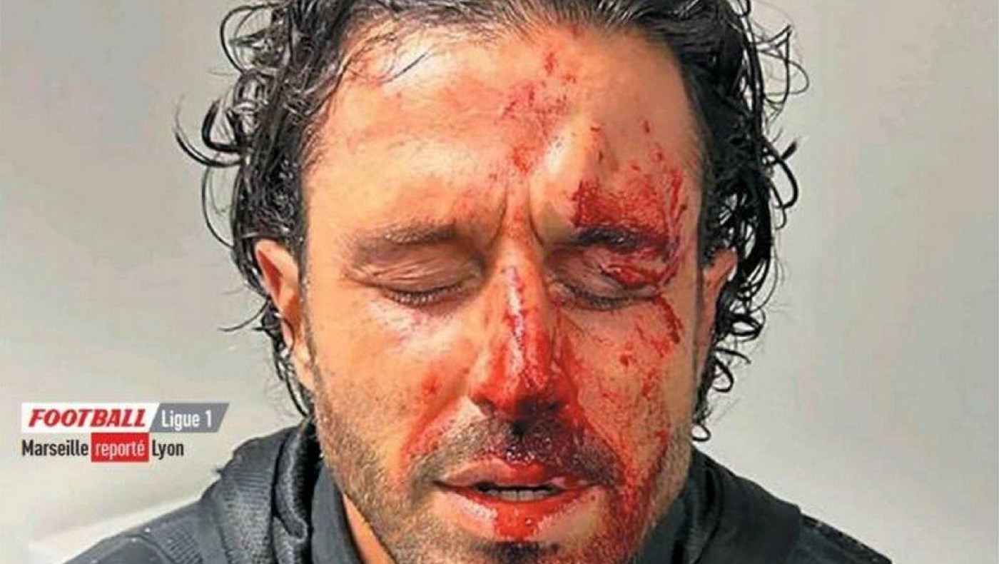 Το συγκλονιστικό πρωτοσέλιδο της Equipe με τον αιμόφυρτο Γκρόσο