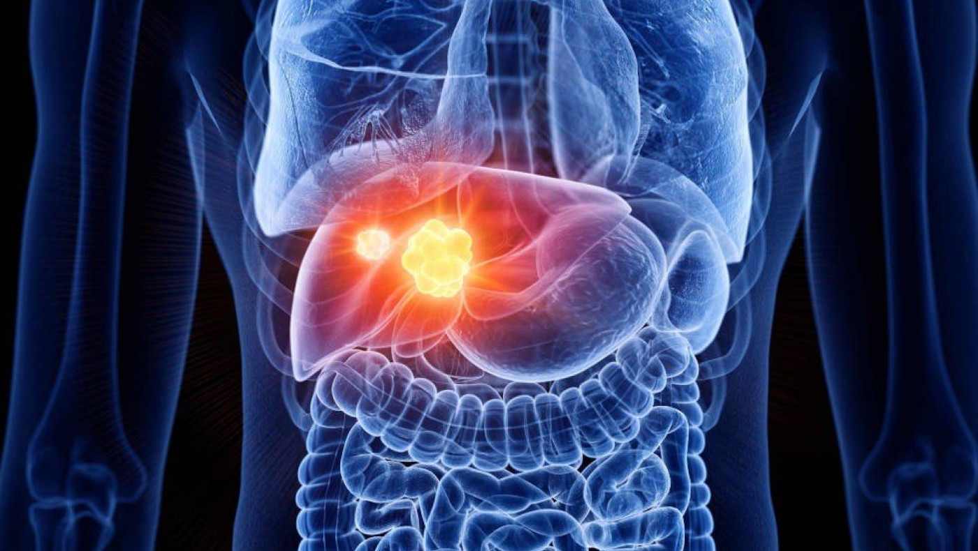 Από Δανία στην Ελλάδα: Δότης σπέρματος με... καρκινογόνο μετάλλαξη-Πέθανε παιδάκι!