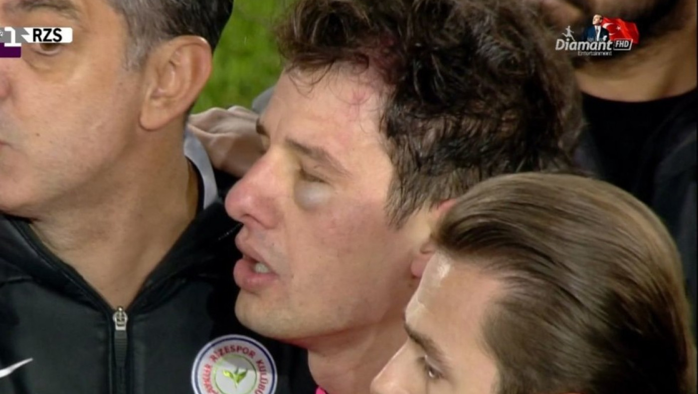 Τουρκία: Ισόβιος αποκλεισμός από τα γήπεδα για τον πρόεδρο που γρονθοκόπησε διαιτητή