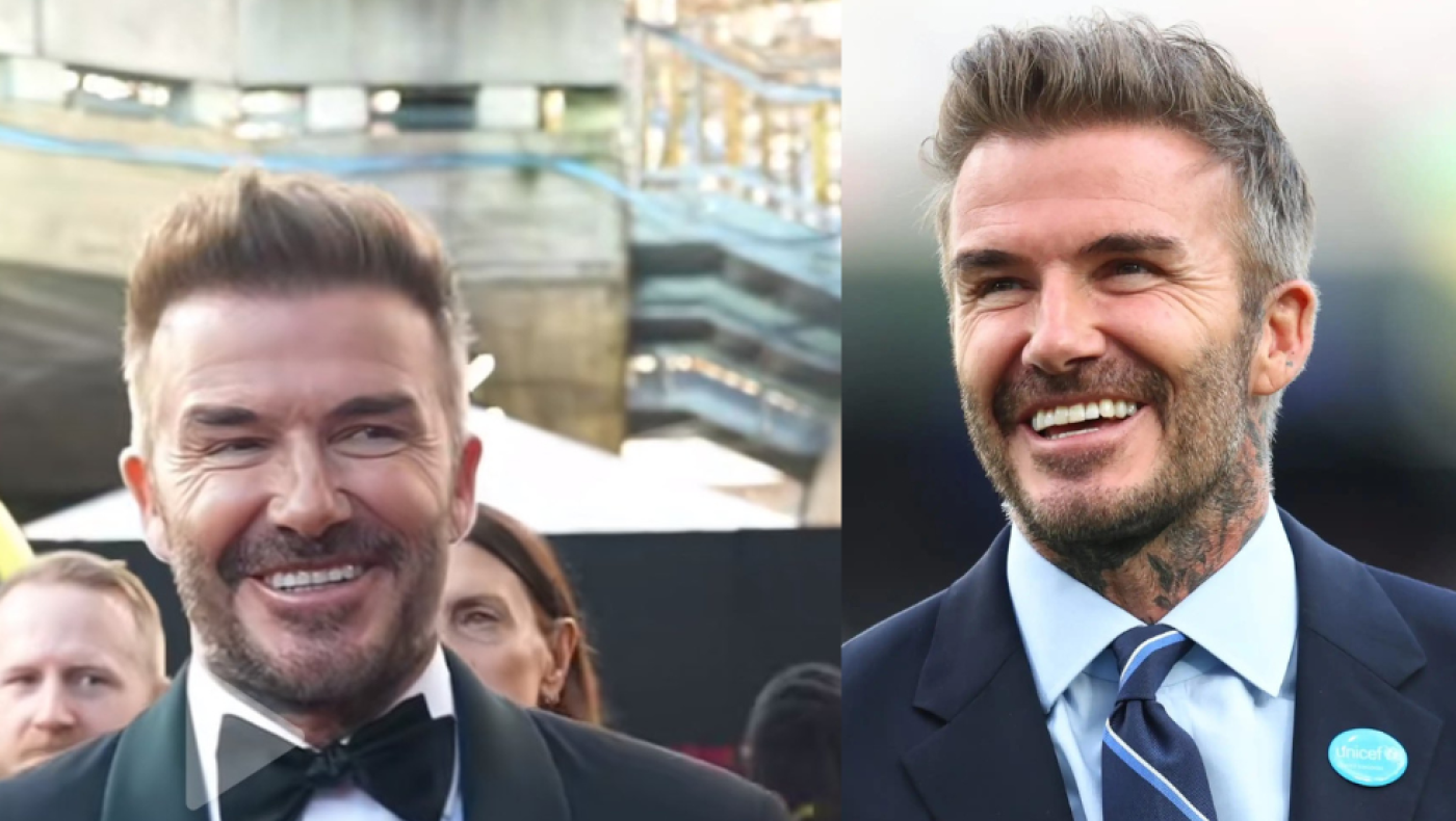 Ντέιβιντ Μπέκαμ: «Το πρόσωπό του δεν κουνιέται από τις πλαστικές»