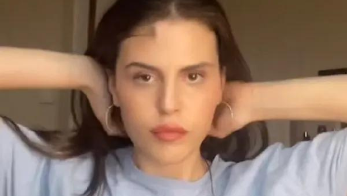 Της «φύτρωσαν» μαλλιά στο μέτωπο: «Μου αρέσουν, δεν θα τα ξυρίσω ποτέ»