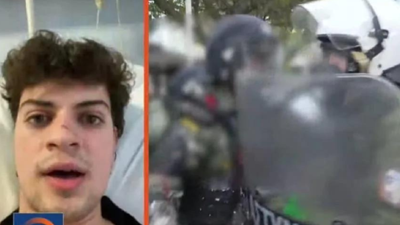 Καταγγελία φοιτητή για αστυνομική βία: «Με χτύπησε κουτουλιά με το κράνος»