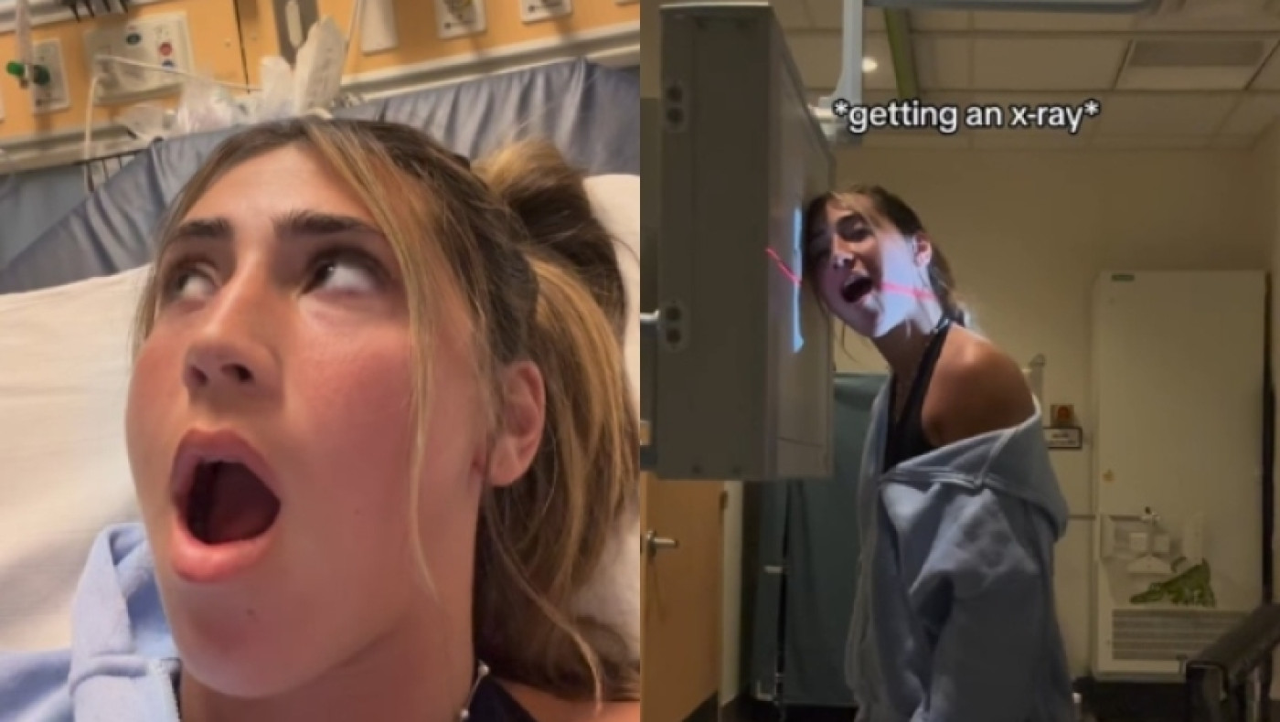 Κοπέλα χασμουρήθηκε τόσο δυνατά που το σαγόνι της «μπλόκαρε», με το στόμα της να μένει ορθάνοιχτο