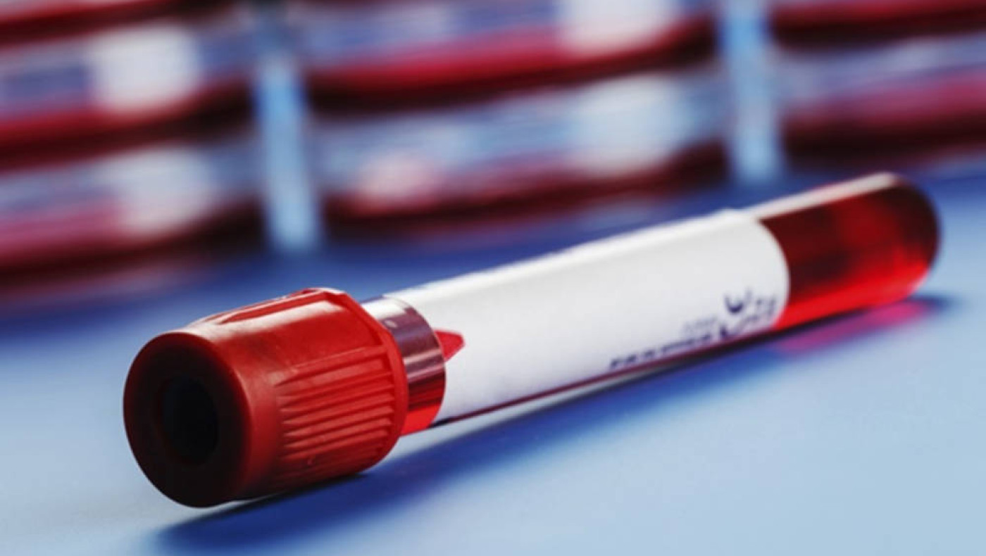 «Χρυσό αίμα»: H σπάνια ομάδα αίματος και πώς θα μπορούσε να σώσει ζωές