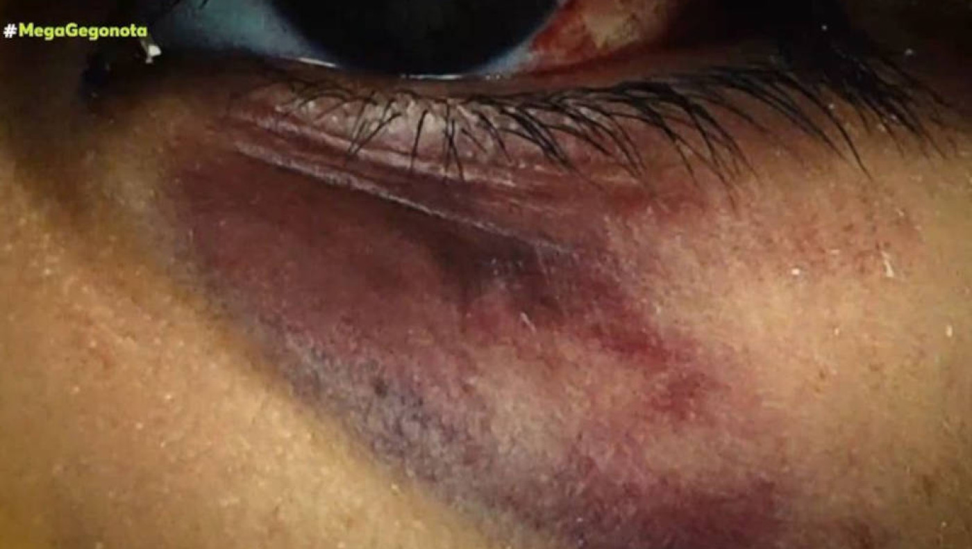 Άγιος Δημήτριος: Άγριος ξυλοδαρμός 15χρονου για... ένα τραγούδι στο Tik Tok