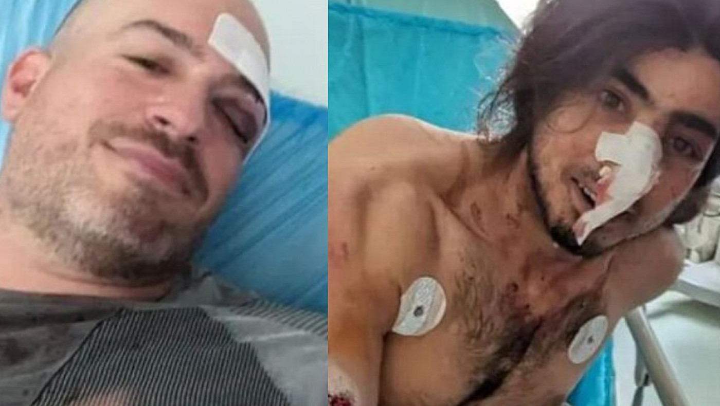 Πάρνηθα: Μαρτυρίες-ΣΟΚ για την επίθεση στους εθελοντές - «Μας χτυπούσαν δίχως έλεος!»