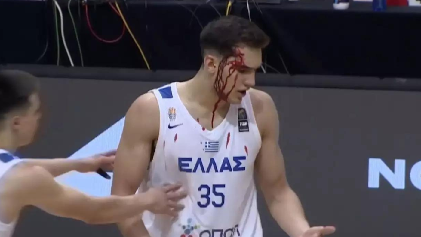 Εθνική Νέων: Ο Ζουγρής μάτωσε και η FIBA τον χαρακτήρισε Έλληνα... πολεμιστή!