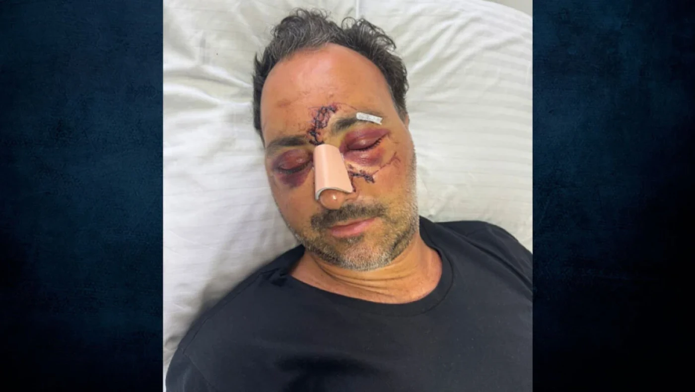 Κρήτη: «Τα χτυπήματα που δέχθηκε ο Ελληνοκαναδός θα μπορούσαν να τον σκοτώσουν»