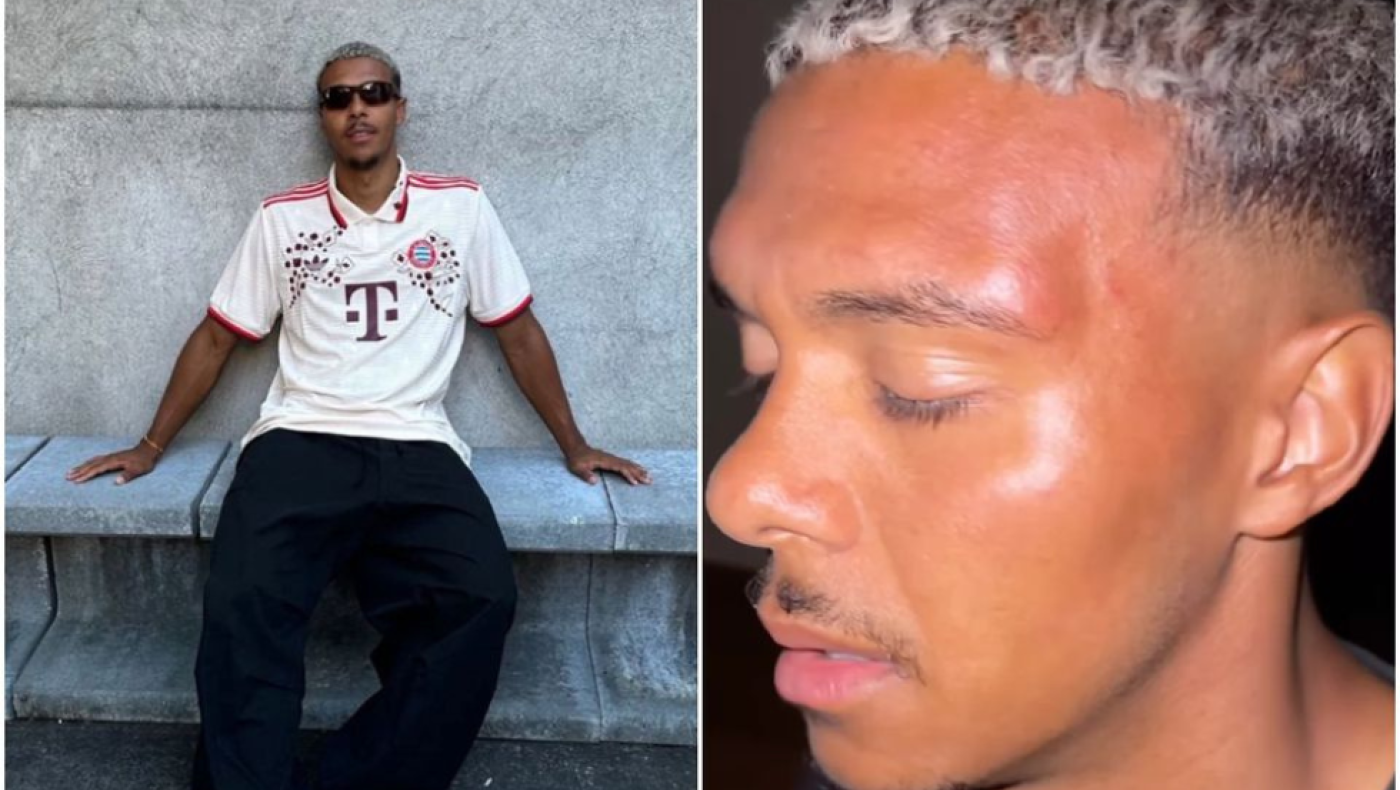 Θύμα ξυλοδαρμού από οπαδούς της ομάδας του ο Νίκλας Σόμερ της Νυρεμβέργης