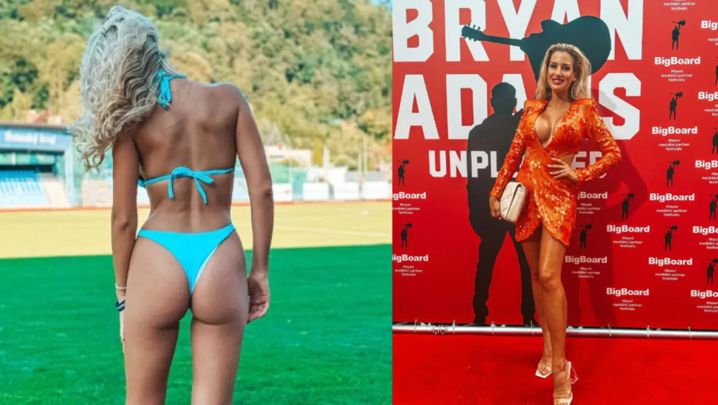 Τσεχία: Προσέλαβε δημοσιογράφο που μοιάζει με την Πάμελα Άντερσον!