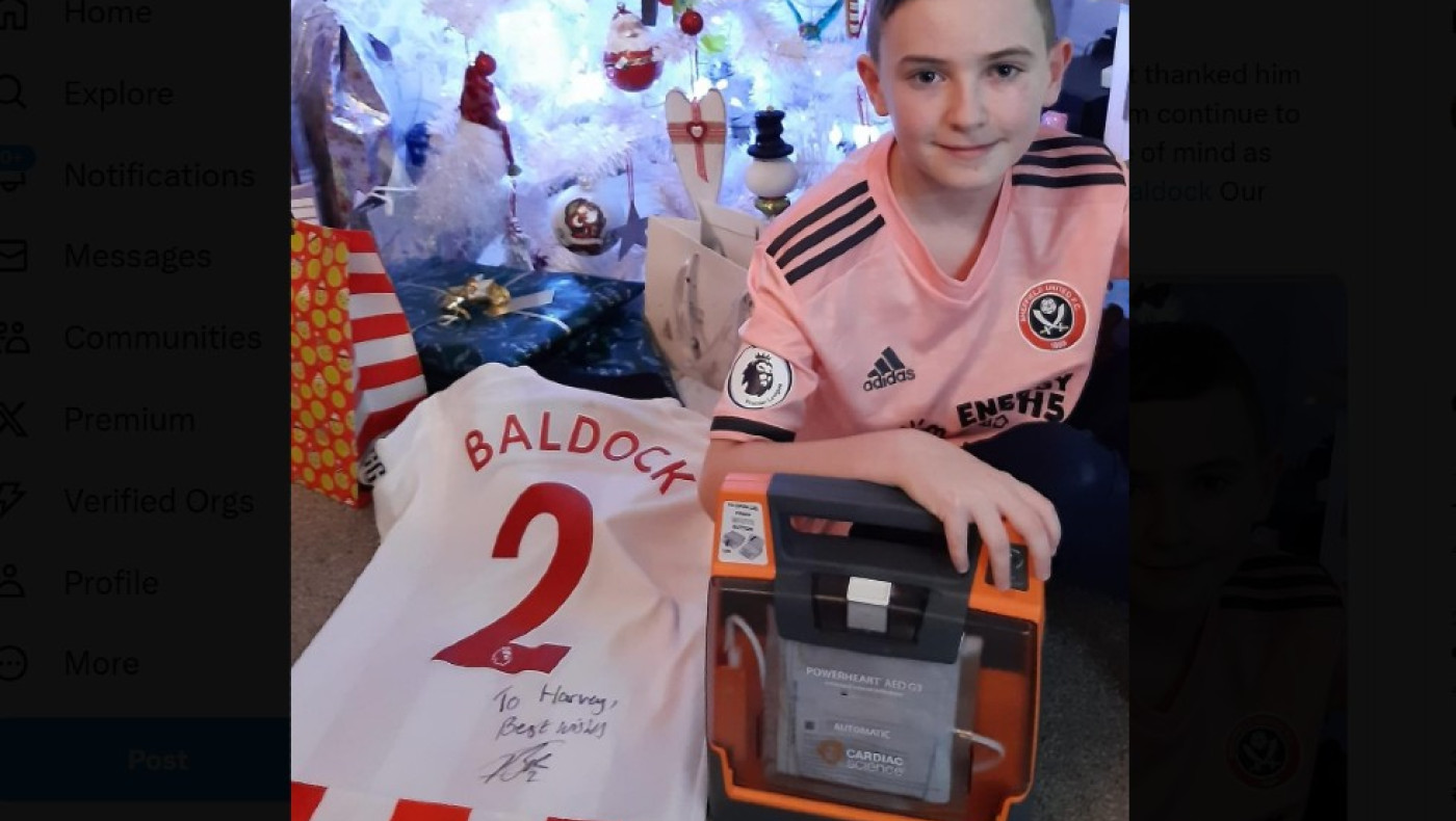 Μπάλντοκ: Είχε σώσει τη ζωή μικρού ποδοσφαιριστή χαρίζοντας απινιδωτή