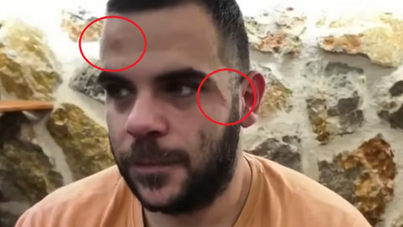 Ξυλοδαρμός YouTuber εν ώρα live στα Ιωάννινα