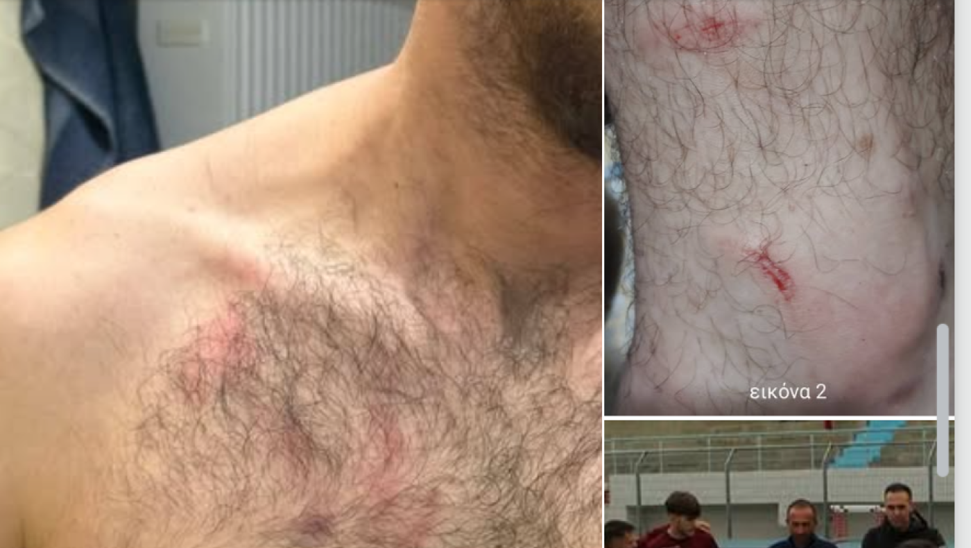 Κιλκισιακός: «Ντράπηκε και η ντροπή»