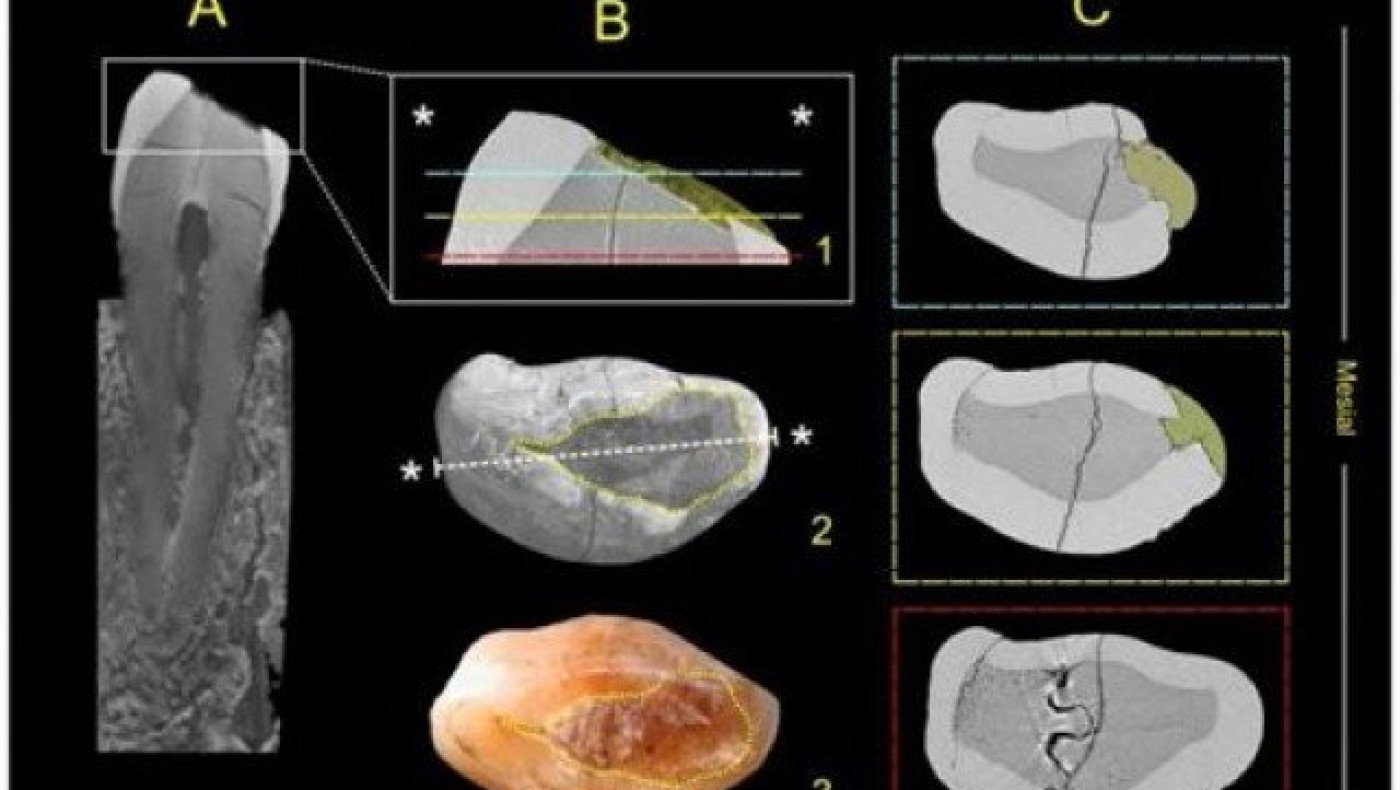 H επίσκεψη στον προϊστορικό οδοντίατρο ήταν... εφιαλτική!