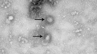 Επιστήμονες υποστηρίζουν ότι παρασκεύασαν εμβόλιο για τον Κοροναϊό!